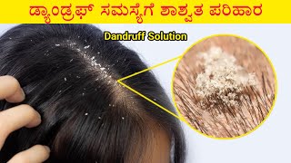 Dandruff ಸಮಸ್ಯೆಗೆ ಶಾಶ್ವತ ಪರಿಹಾರ | Dandruff home remedy | Namma facts in kannada screenshot 5