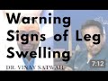 Self Diagnose Leg Swelling | Vascular Specialist