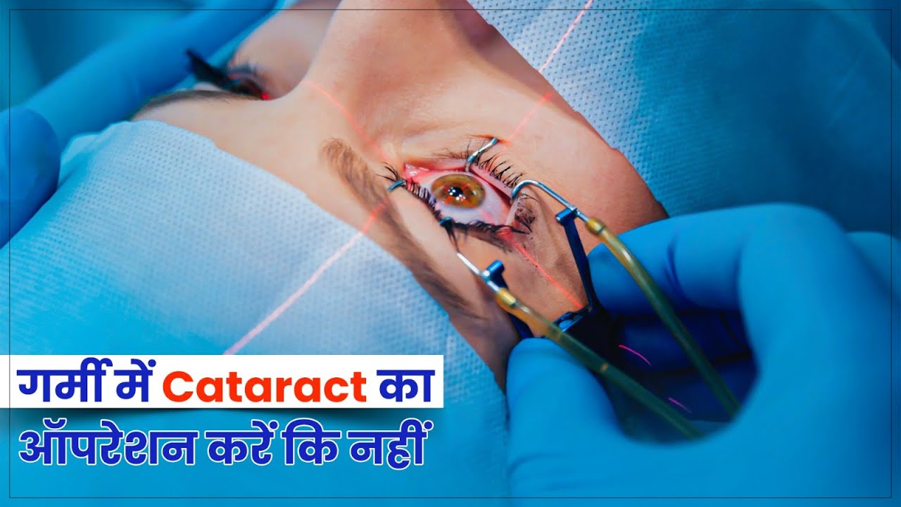 cataract-client-klarity-eye-care