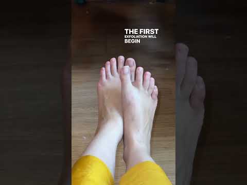 A Must Buy For Winter Season Luxaderme Foot Peeling And Exfoliating Mask