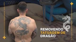 Ele Decidiu Remover um Dragão Gigante das Costas 😱 | Remoção de Tatuagem
