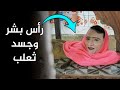رأس انسان وجسد ثعلب كائن مخيف يظهر في حديقة الحيوان ويزوره الناس بالملايين