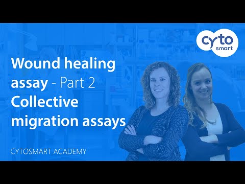 How to perform collective cell migration assays - Wound healing assay - CytoSMART Academy