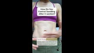 How do you control swelling after a C-section? Did You Have Swelling After A Long Induction Or C Section