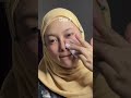 Selama ada PeelingPad Skintific Kalah gamungkin, menang gakaget😜 #peeelingpad #skintific #skincare