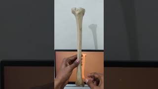 Tibia side determination | 3D anatomy.