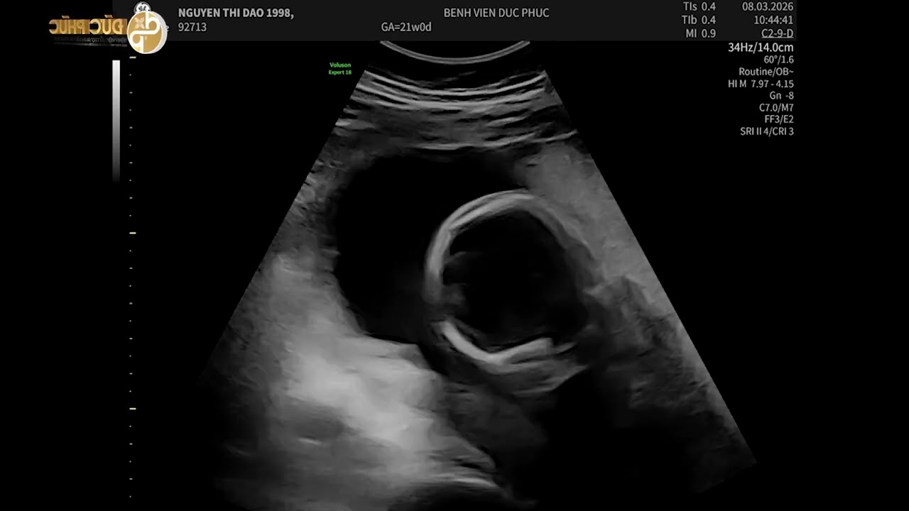 Đức Phúc gửi mẹ bầu Nguyễn Thị Đào