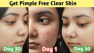 Get Pimple Free Clear Skin In 30 Days | Winter Skincare For Acne Prone Skin || Acne Treatment