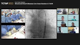 [TCTAP 2022] Structural Heart Disease Live Case Session 4: TAVR