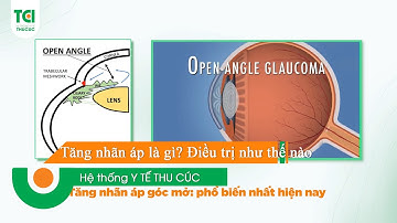 💥 Bệnh tăng nhãn áp là gì? Đâu là cách điều trị hiệu quả