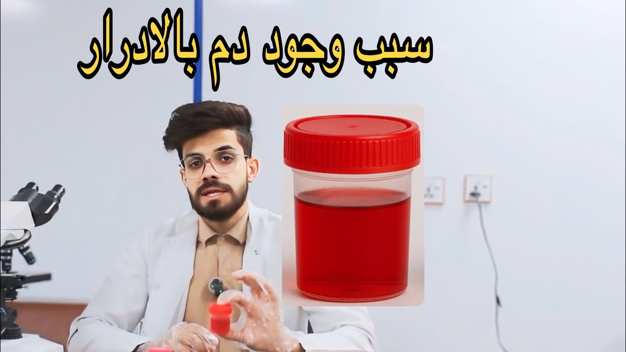 سبب وجود دم بالادرار ، واسباب ظهور الادرار بلون احمر . الاستاذ علي السماري