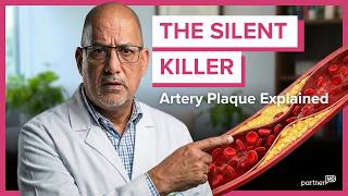 Artery Plaque Explained How It Forms & How To Stop It