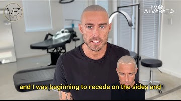 SMP Scalp Micropigmentation Austin, Texas - David Testimony