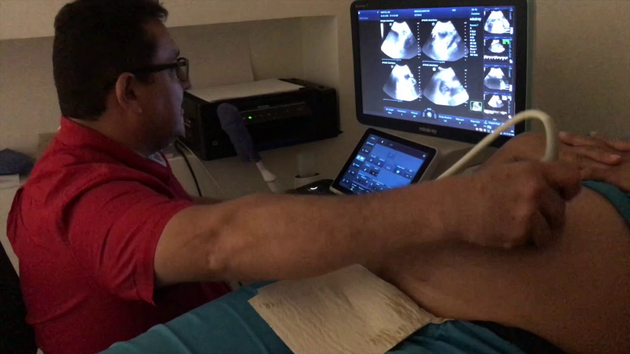 Ecografia Doppler Obstetrico