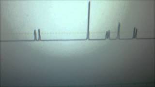 CURCUMIN Calculation of NMR chemical shifts