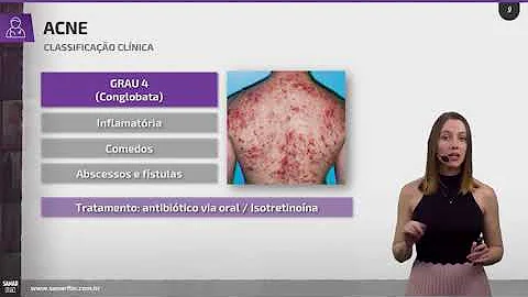 Como curar erupções Acneiformes?