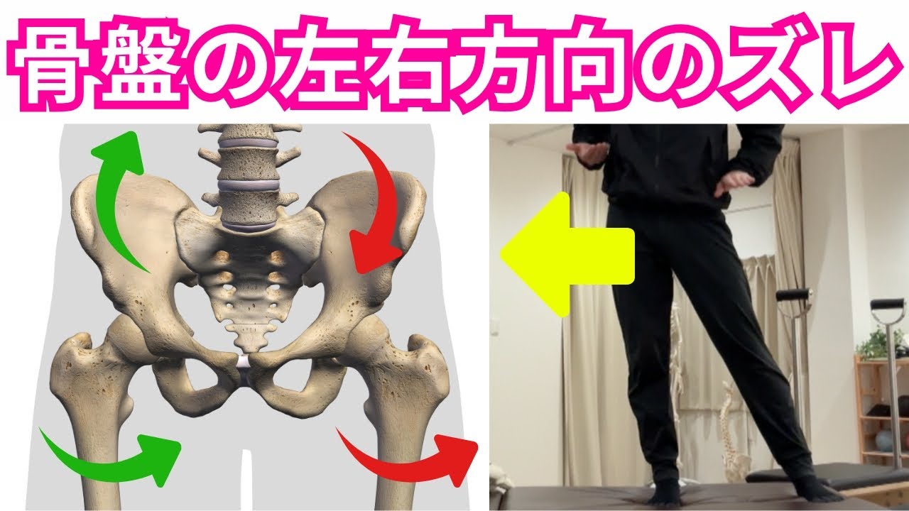 骨盤の横ズレを見ると、腰椎と股関節の問題が分かります！