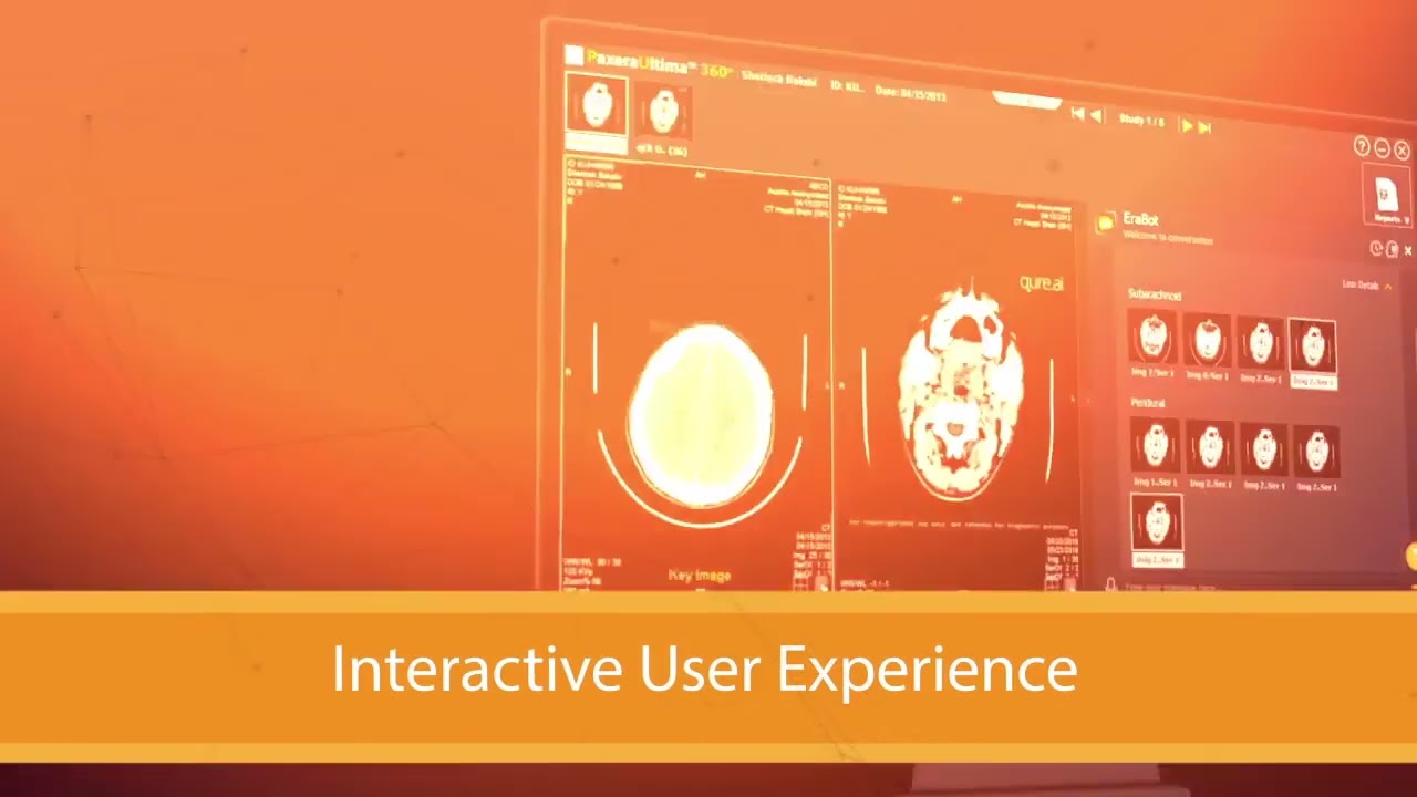 PaxeraUltima AI Medical Imaging