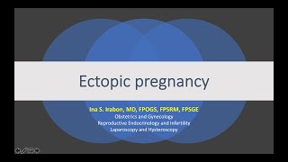 Ectopic Pregnancy