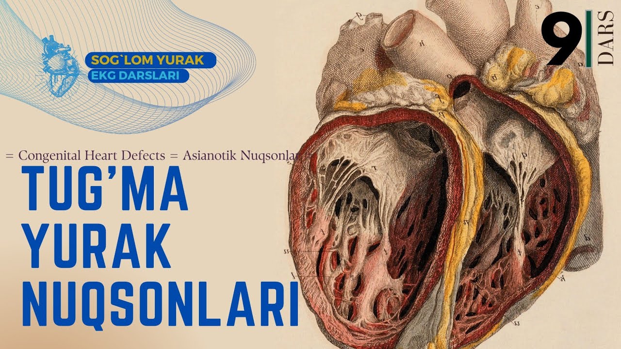 = Tug'ma Yurak Nuqsonlari = Asianotik Nuqsonlar = Congenital Heart Defects =