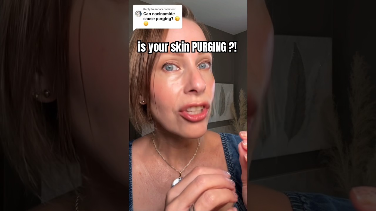 SKIN PURGING | HOW TO KNOW 🤷‍♀️