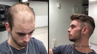 Aplicación de indetectable (David) parte 2 - Hair Inspira - YouTube