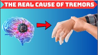 The REAL CAUSE of TREMORS Alternative SOLUTION