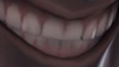 tf2 android but your phone is shit Part 6