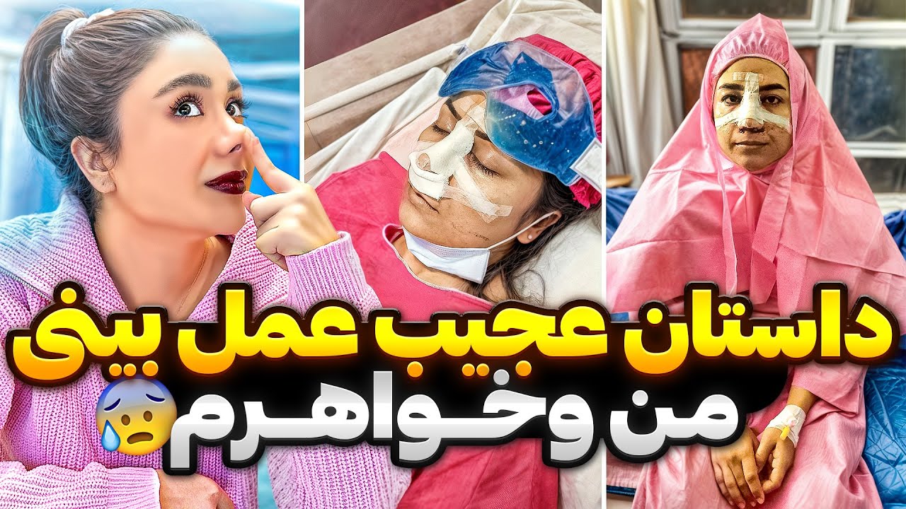 چرا از عمل بینی ام پشیمون شدم؟!