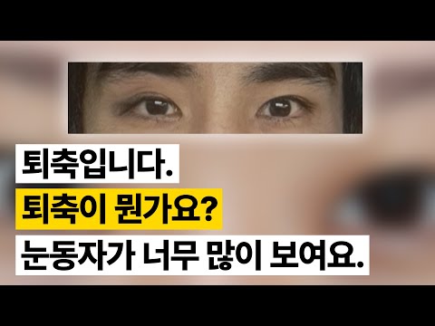 성형상담소 💌 I 예전 눈으로 돌아가고 싶어요  I 퇴축 교정 고민 해결해주세요