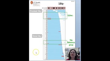2018 18q- Handout