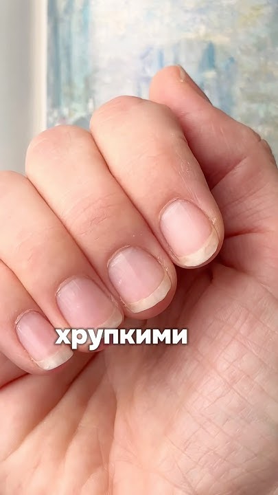 Как восстановить ногти после гель-лака? Как вы справились? Я вот ...