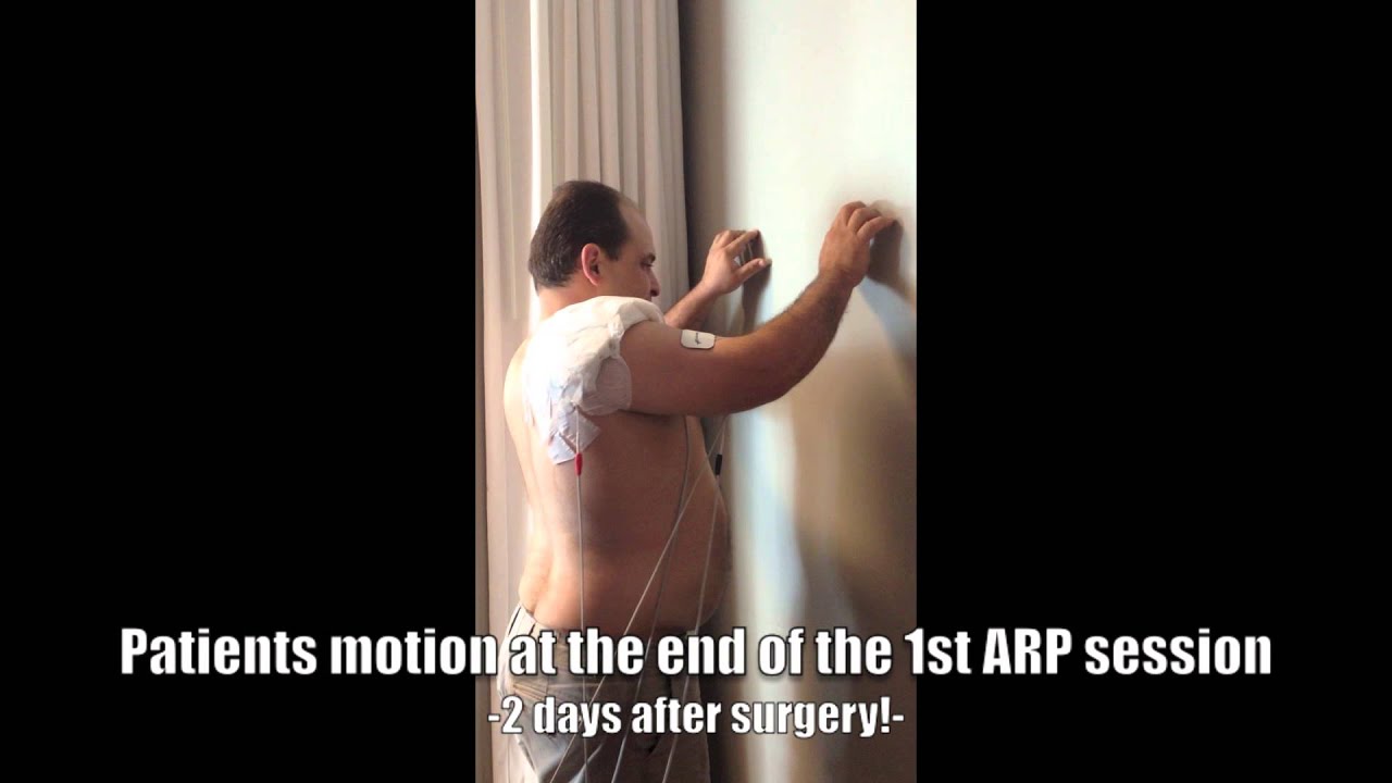 Arp Wave Treatment After Shoulder Surgery Youtube Arp Wave Treatment After Shoulder Surgery Youtube