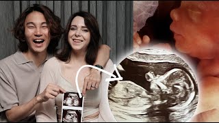 Q&A: we got PREGNANT! Was it planned? Parents reaction?