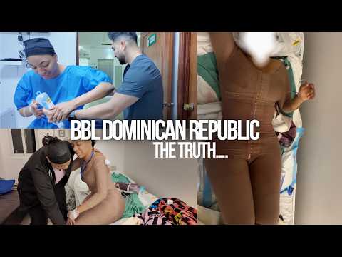 Dominican Republic BBL Experience The Truth About Recovery, BODY , Pain & Wht Nobody Tells  Part 4