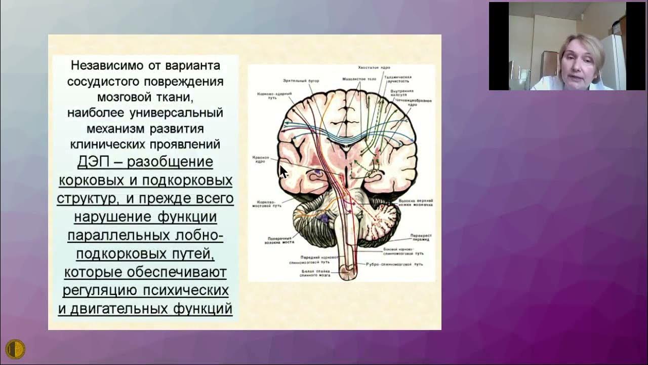 Ишемия мозга 2 ст. Ишемическая болезнь головного мозга. Строение мозга. Головная боль при хронической ишемии мозга.