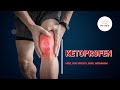 #Ketoprofen | Uses, Dosage, Side Effects & Mechanisms | Orudis