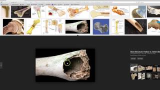 API  Skeletal System