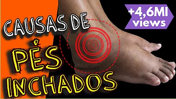 O que fazer p desinchar os pés por causa da diabete?