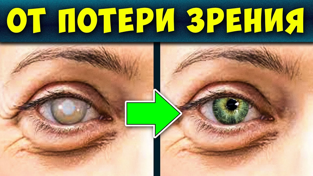 Восстановление Зрения Стоимость