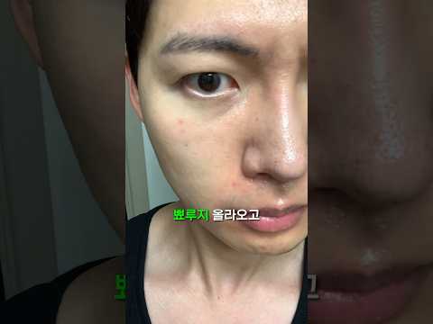 무조건 피부 좋아지는 방법 3가지 (여드름 트러블 <strong>홍조</strong> 모공)
