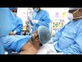 Man going under general anesthesia