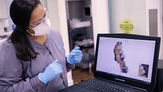 Not all same day dentistry solutions are the same