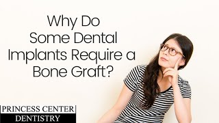 Why Do Some Dental  implants Require a Bone Graft?