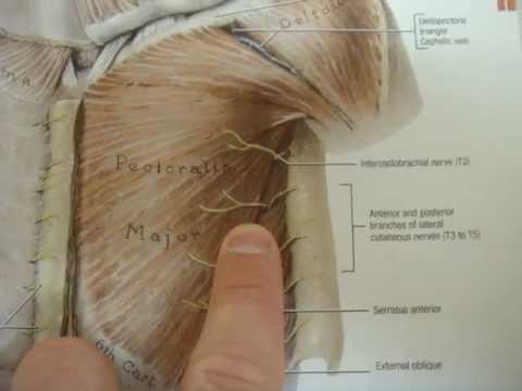 Chest wall pain from intercostal nerve injury - YouTube