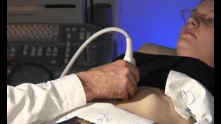 ECBv Ch 17 Aorta 2 SMA