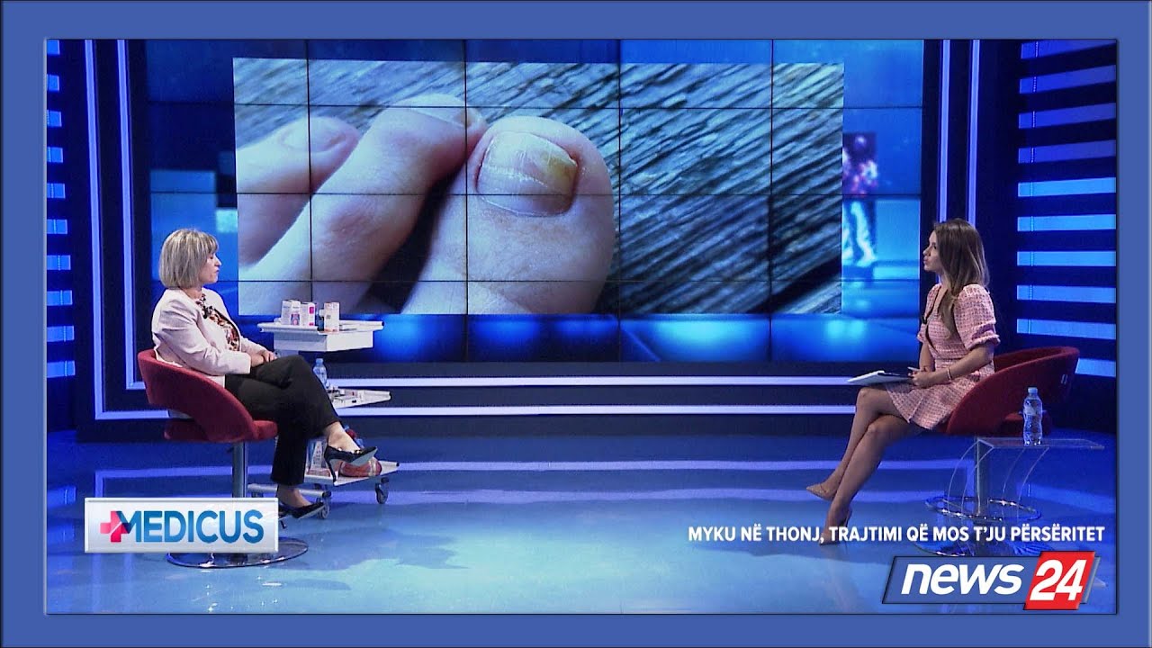 MEDICUS / Trajtimi i mykut të thonjve që mos t’ju përsëritet