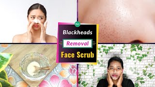 How To Remove Blackheads From Nose and Face Naturally At Home || Homemade Face Scrub For Blackheads screenshot 2