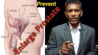 Prostate Problem 4 Prostate