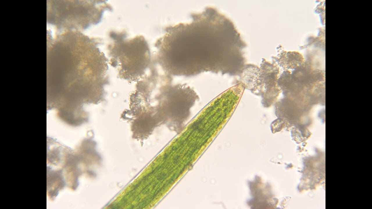 Closterium's Vibrating Crystals